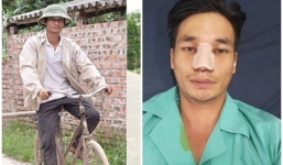 Diện mạo mới của Lệ Rơi sau khi 'đập mặt xây lại'