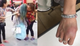 Mới sinh con, Bella tiếp tục gây chuyện bị đánh sưng người