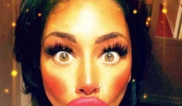 Những khuôn mặt không thể xấu hơn hậu thẩm mỹ