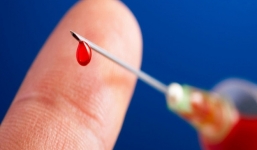 Kẻ thuê người tiêm máu HIV vào bé trai thoát án tù nhờ giấy chứng nhận 'tâm thần'