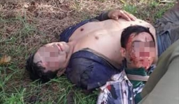 Cứu người tai nạn, đánh 'cẩu tặc' bị nhiễm HIV: Xử lý phơi nhiễm HIV thế nào?