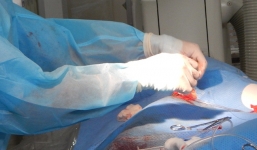 Những góc khuất trong cấp cứu động mạch vành không phải ai cũng biết