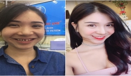 Lộ ảnh 'dìm hàng' của hàng loạt sao nữ Việt khiến fan bất ngờ