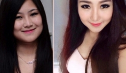 Sao Việt phẫu thuật thẩm mỹ: Người thành công, kẻ 'thảm họa'