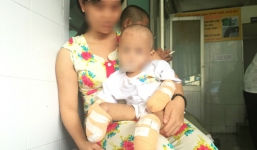 Bé gái 2 tuổi phải cắt bỏ chân tay vì bố mẹ mải mê kiếm tiền