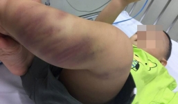 Vụ bé trai 1 tuổi nghi bị bạo hành ở Hà Nội: Công an vào cuộc