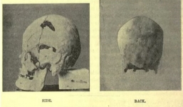 Pharaoh Ai Cập có thể là 'người khổng lồ' cổ xưa nhất