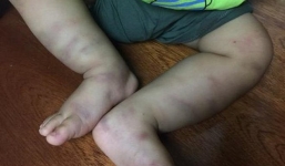 Vụ bé trai 14 tháng bị bạo hành dã man, bỏ lại bệnh viện: Lộ diện người liên quan