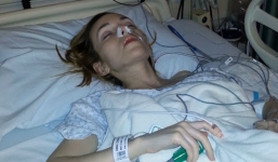 Ít ai ngờ rằng nấm mốc chính là thủ phạm khiến cô gái ở Mỹ chỉ còn nặng 31kg