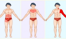 Những cơn đau xuất hiện trên cơ thể cảnh báo bệnh nguy hiểm