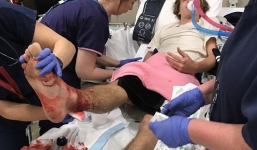 Xác định được sinh vật ăn thịt người bí ẩn gây hoang mang những ngày qua