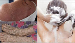 Có nên tắm hằng ngày không?