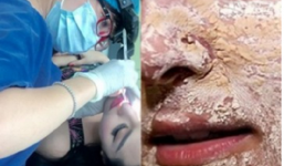 “Kinh dị” với cách làm đẹp kinh dị của sao