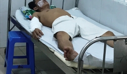 Sau tiếng nổ bất ngờ, 4 công nhân bị bỏng nặng