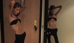 Giảm cân quá đà khi bị chê béo, cô gái xinh đẹp tự biến mình thành bộ da bọc xương khiến ai nhìn cũng hoảng sợ