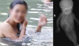 Quen tắm sông khi mang thai, kết quả siêu âm khiến bà mẹ trẻ bàng hoàng