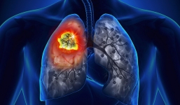 Hãy bổ sung 9 thực phẩm này vào bữa ăn hằng ngày để giảm nguy cơ bệnh tật