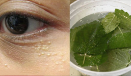Đánh bay mụn thịt quanh mắt bằng nguyên liệu sẵn có tại nhà