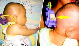 Nguời mẹ nhanh trí cứu con nhỏ bị đồ chơi cắm vào đầu thoát chết 