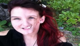 Cô gái xinh đẹp mắc chứng bệnh lạ khiến mặt trở nên méo mó