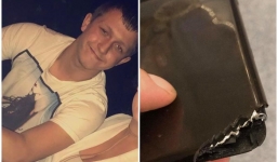 Bị máy cưa cắt vào chân, người đàn ông may mắn sống sót nhờ... iPhone