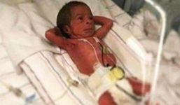 Siêu vui nhộn, em bé vừa mới ra đời 1 tiếng đã nằm “suy ngẫm về cuộc đời”