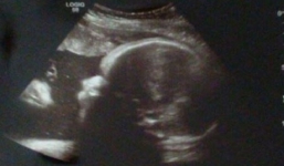 'Chúa Jesus' xuất hiện trong ảnh siêu âm em bé sắp chào đời