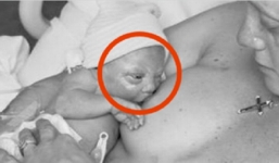 Xúc động với bà mẹ bị cắt một bên ngực vẫn cho con bú