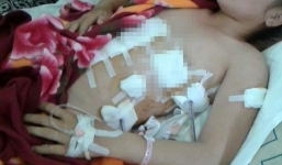 Đi đánh ghen, vợ bị 'bồ nhí' của chồng đâm trọng thương