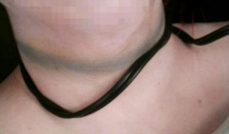 Người cha siết cổ con nuôi rồi uống thuốc trừ sâu tự tử