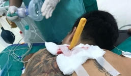 Nam thanh niên xăm trổ bị bạn gái cầm dao đâm thủng phổi