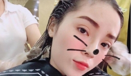 Mắt sưng húp, Kỳ Duyên lại vướng nghi vấn phẫu thuật thẩm mỹ