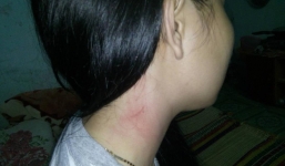 Tìm ra nhóm giang hồ đánh người nhờ chiếc điện thoại lạ tại hiện trường