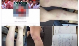 Chủ tịch Hà Nội yêu cầu làm rõ vụ 11 học sinh lớp 2 bị giáo viên bạo hành