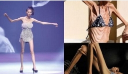 Khoan 'ném đá ' Cao Ngân, 6 người mẫu còn thảm thương hơn