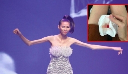 Hé lộ sự thật đau lòng phía sau vóc dáng 'da bọc lấy xương' của Cao Ngân 