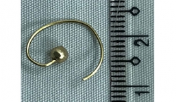 Nuốt khuyên tai, bé gái bị tổn thương thực quản