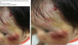 Truy tìm nam thanh niên lái xe phân phối lớn tông vào bé gái 11 tháng tuổi rồi bỏ chạy