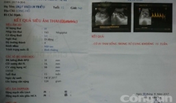 Bà nội dẫn cháu 15 tuổi mang bầu đến trình báo công an