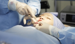 Sài Gòn: Phẫu thuật gọt cằm, một phụ nữ bị nguy kịch