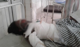 Thiếu nữ bị tưới dầu thiêu sống vì không chịu lấy kẻ theo đuổi mình