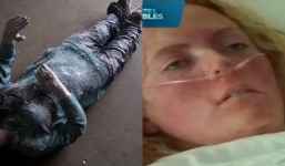 Tưởng chừng như bị đông cứng ngoài trời -33 độ C, cô gái bất ngờ sống lại khiến mọi người sửng sốt