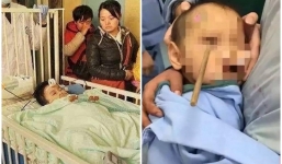 Bé trai 3 tuổi bị đũa cắm sâu vào mắt tử vong do sự bất cẩn của bố mẹ