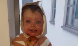 Thấy con trai bị bỏng, người mẹ hoảng loạn khiến con đau đớn với những vết sẹo lớn