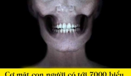 10 sự thật 'kinh ngạc' về cơ thể mà 99\% bạn không hề hay biết