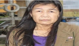 Cô gái 22 tuổi mang khuôn mặt bà lão 80 gây sốc