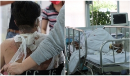 Giám đốc công ty bị giang hồ chặn đầu xe, đốt ô tô, xịt hơi cay vào mặt