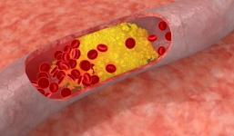 Bỏ bữa sáng: Thói quen có thể làm tăng nguy cơ mắc căn bệnh gây tử vong hàng đầu thế giới