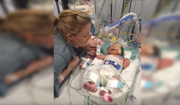 Em bé chào đời lúc 5 tháng khi tim đã ngừng đập, 8 phút sau ai cũng choáng vì điều kỳ diệu