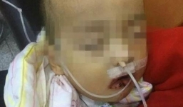 Tưởng nhầm chất tẩy là đường trắng, bé trai lấy ăn và nhập viện trong tình trạng nguy kịch